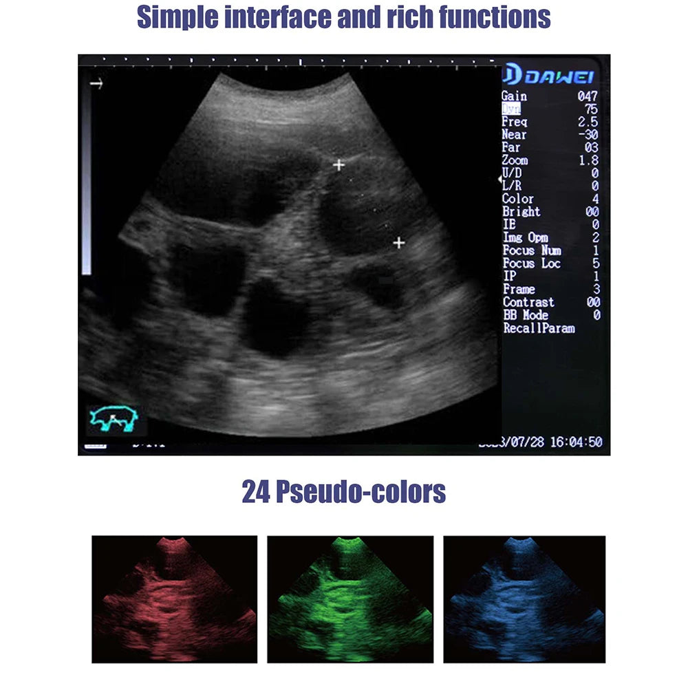Portable Ultra Pregnancy UV Scanner Vet B-Handheld, (B, BB, 4B, B+M, M) for livestock